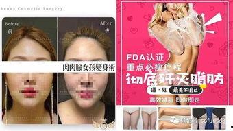 韩美整形最新爆料,最新爆料揭露行业乱象!” 第2张 韩美整形最新爆料,最新爆料揭露行业乱象!” 第2张